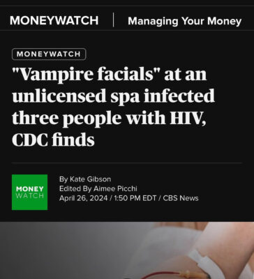 Illegal Vampire Facial leads to HIV